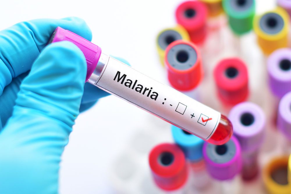 ไข้มาลาเรียสายพันธุ์โนวไซ ระบาดติดจากลิงสู่คน