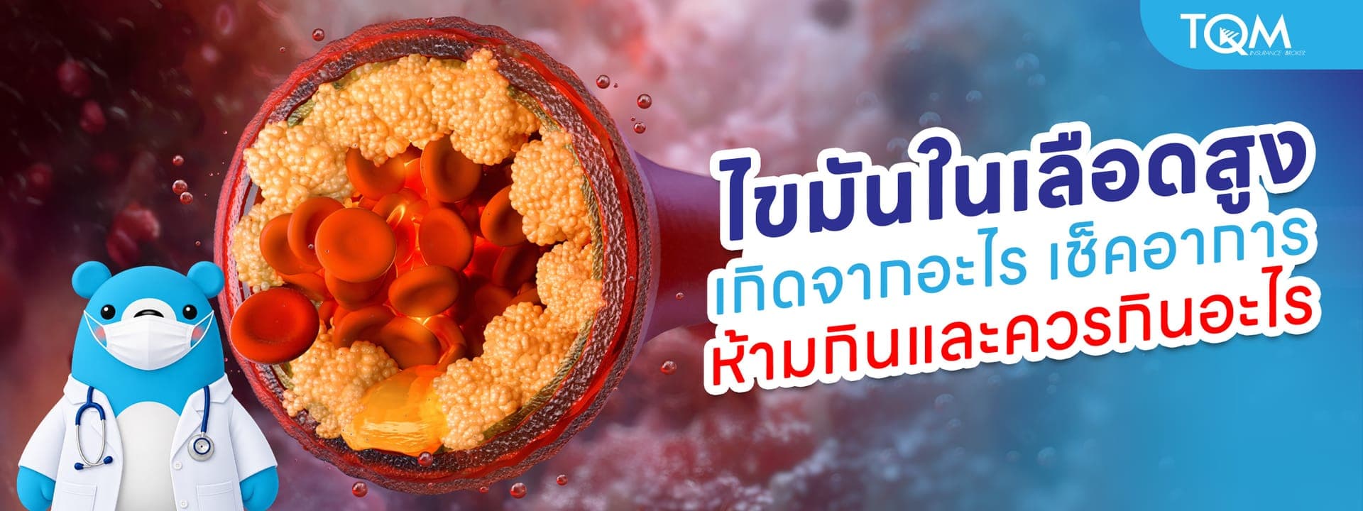 ไขมันในเลือดสูง เกิดจากอะไร อาการเป็นอย่างไร ห้ามกินอะไร