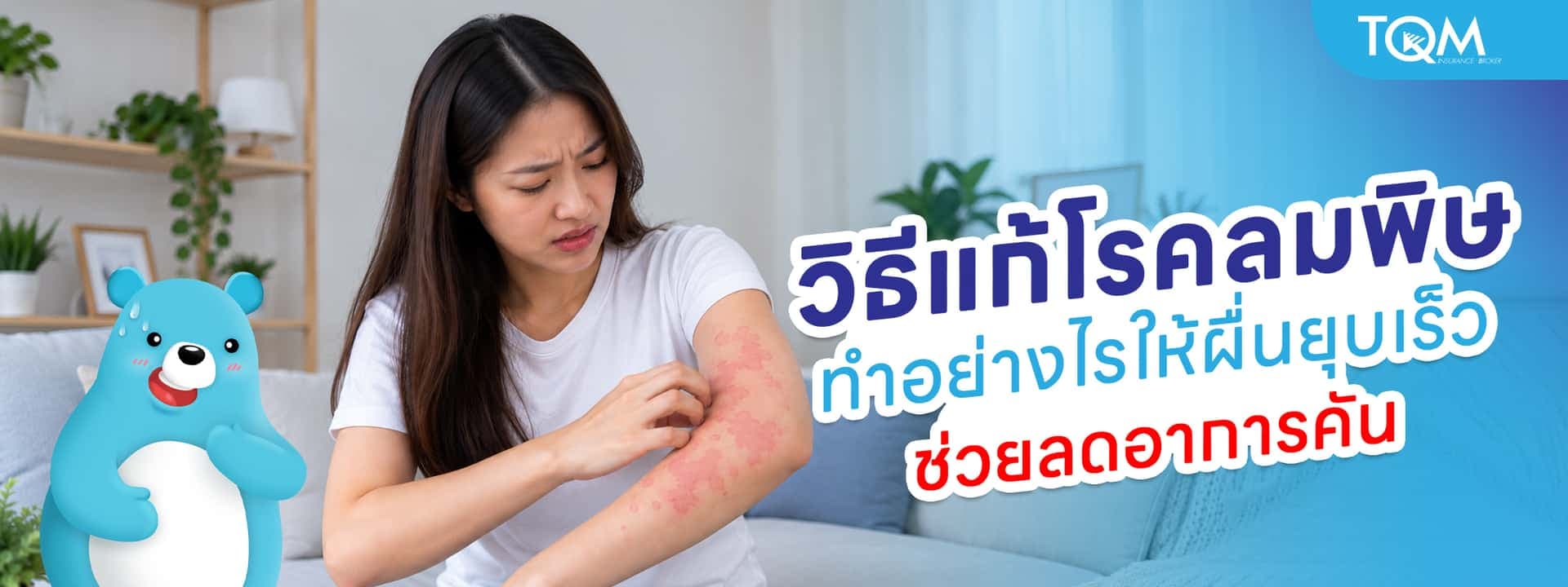 วิธีแก้โรคลมพิษเบื้องต้น ทำอย่างไรให้ผื่นยุบเร็ว ลดอาการคัน